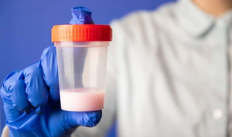 O congelamento de espermatozoides é uma opção para homens que desenvolvem câncer de próstata, mas ainda desejam reproduzir