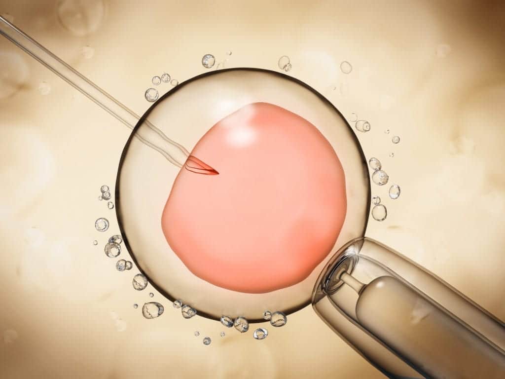ICSI - Injeção intracitoplasmática de espermatozoide na fertilização in Vitro passo a passo. ICSI - Injeção intracitoplasmática de espermatozoide na fertilização in Vitro passo a passo.