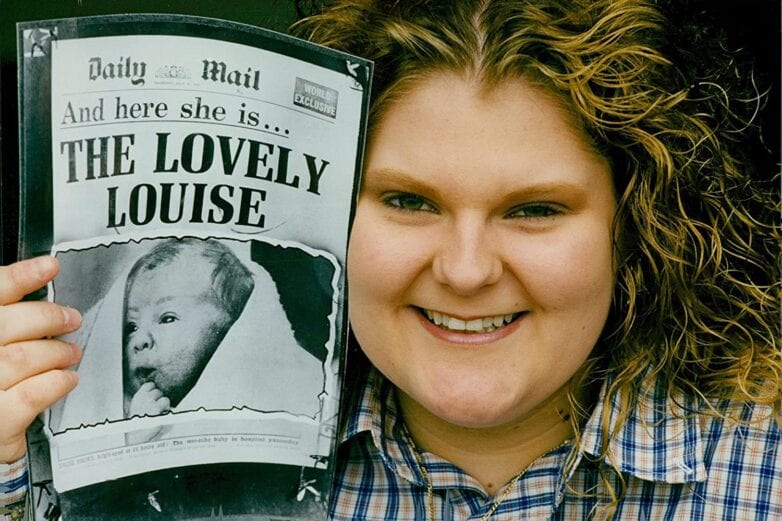 Louise Brown segura o jornal onde foi noticiado o nascimento do primeiro bebê de proveta do mundo.