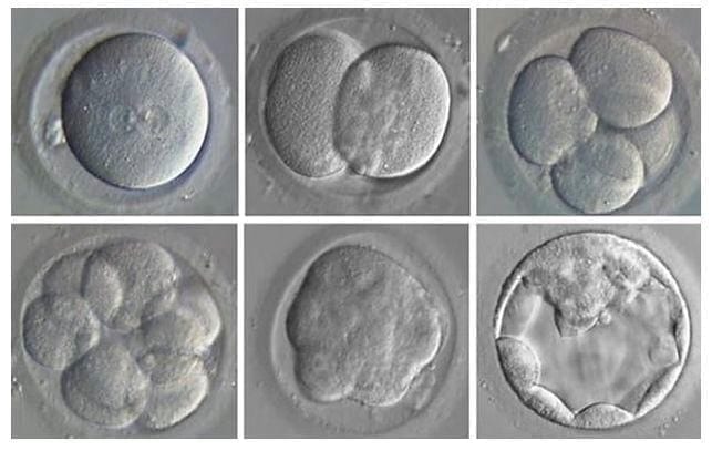 Processo de desenvolvimento do embrião após a Fertilização in Vitro.