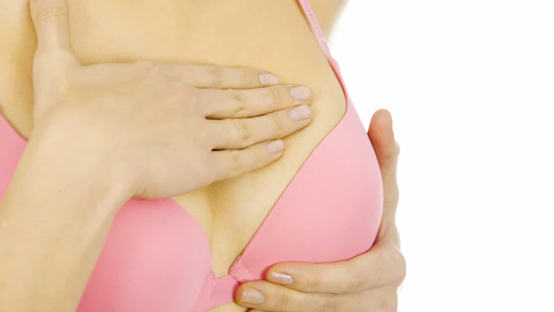 Indução ovariana não estimula o desenvolvimento do câncer de mama, que pode ser identificado pelo autoexame, como na foto. 
